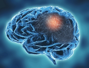 Neuro Breakthroughs  Neuro Breakthroughs